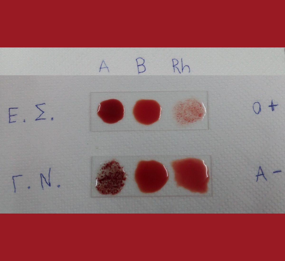 Ομάδες Αίματος –  ανίχνευση στο εργαστήριο